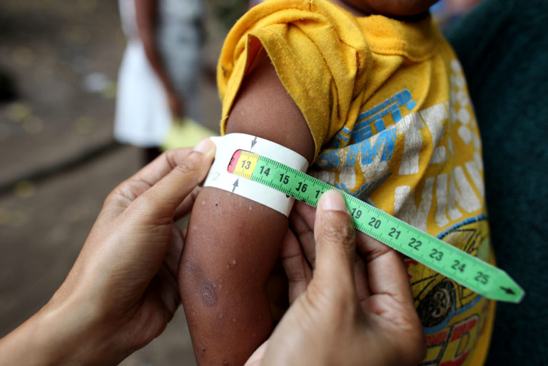 Ending Malnutrition Key to Sustainable Development