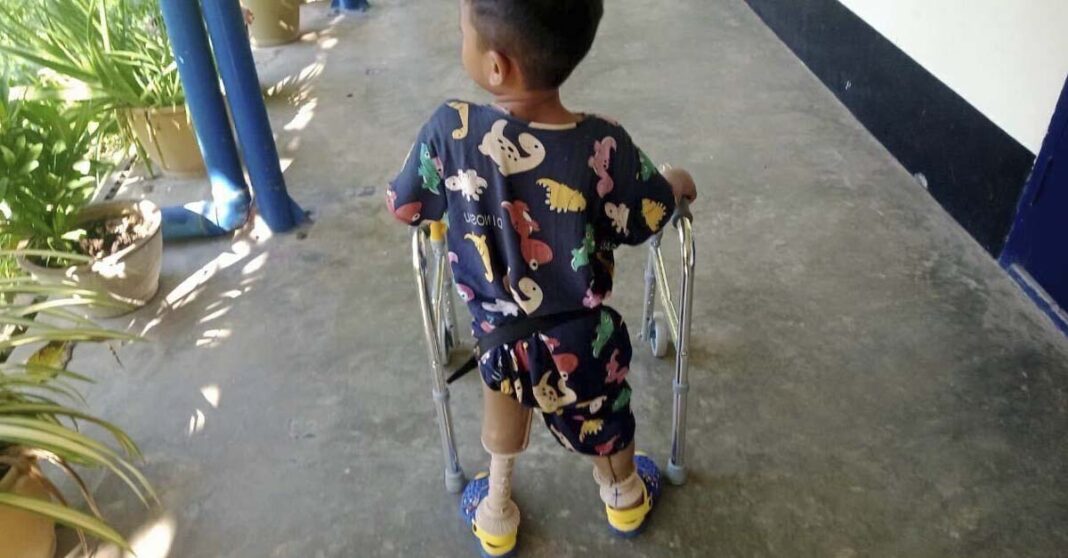 In this photo provided by the family, a young landmine victim learns to use his new prosthetic limbs at Hpa-An Orthopedic Rehabilitation Center in Hpa-An township, Karen State, Myanmar, on Dec. 7, 2022. The boy lost his legs in a landmine blast in July 2022. He speaks frequently about the blast, but his mother isn't sure he'll ever process what happened. “Maybe he still doesn’t understand,” she said. “He is still young.” (Family photo via AP)