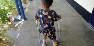 In this photo provided by the family, a young landmine victim learns to use his new prosthetic limbs at Hpa-An Orthopedic Rehabilitation Center in Hpa-An township, Karen State, Myanmar, on Dec. 7, 2022. The boy lost his legs in a landmine blast in July 2022. He speaks frequently about the blast, but his mother isn't sure he'll ever process what happened. “Maybe he still doesn’t understand,” she said. “He is still young.” (Family photo via AP)