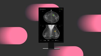Lunit’s AI identified more cancers, but radiologists recalled fewer of those cases—highlighting a trust gap in clinical decision-making.