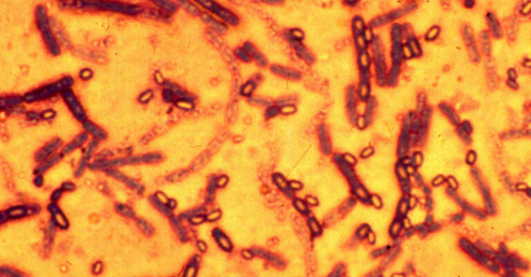 Laos Halts Meat Imports from Thailand Following Fatal Anthrax Case