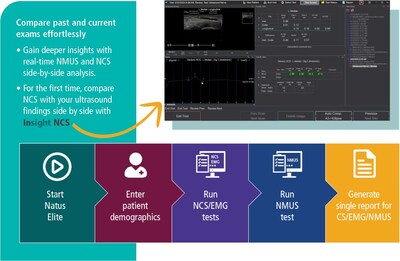 Combining InVisus Pro with Natus Elite makes it simple for doctors and clinicians to compare current and past exams to gain deeper insights. This includes side-by-side, real-time analysis of NMUS and nerve conduction studies (NCS). Infographic: NMUS Integration workflow and Insight NCS Combining InVisus Pro with Natus Elite makes it simple for doctors and clinicians to compare current and past exams to gain deeper insights. This includes side-by-side, real-time analysis of NMUS and nerve conduction studies (NCS). Infographic: NMUS Integration workflow and Insight NCS