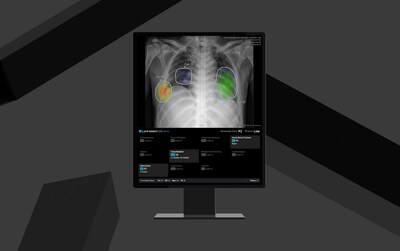 The next-generation Lunit INSIGHT CXR4 interface showing AI-powered analysis of a chest X-ray. The solution supports detection of 12 chest abnormalities, including lung nodules, pneumonia, and acute bone fractures. (Image courtesy of Lunit)