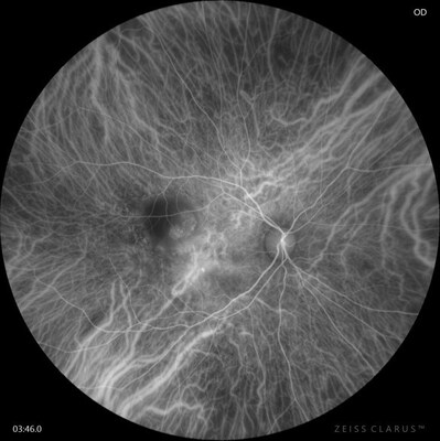Carl_Zeiss_Meditec_AG_CLARUS_700_with_ICGA_modality Carl_Zeiss_Meditec_AG_CLARUS_700_with_ICGA_modality