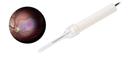Carl_Zeiss_Meditec_AG_New_Midfield_endoillumination_light_probe_with_directed_light Carl_Zeiss_Meditec_AG_New_Midfield_endoillumination_light_probe_with_directed_light