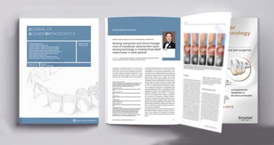 Prof. Gang Shen’s Research Paper about Mandibular Advancement Repositioning Technology in the Journal of Aligner Orthodontics Prof. Gang Shen’s Research Paper about Mandibular Advancement Repositioning Technology in the Journal of Aligner Orthodontics