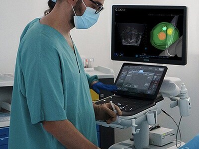 Prostate Attention Map (PAM), Esaote’s new innovative technology dedicated to urology. Prostate Attention Map (PAM), Esaote’s new innovative technology dedicated to urology.